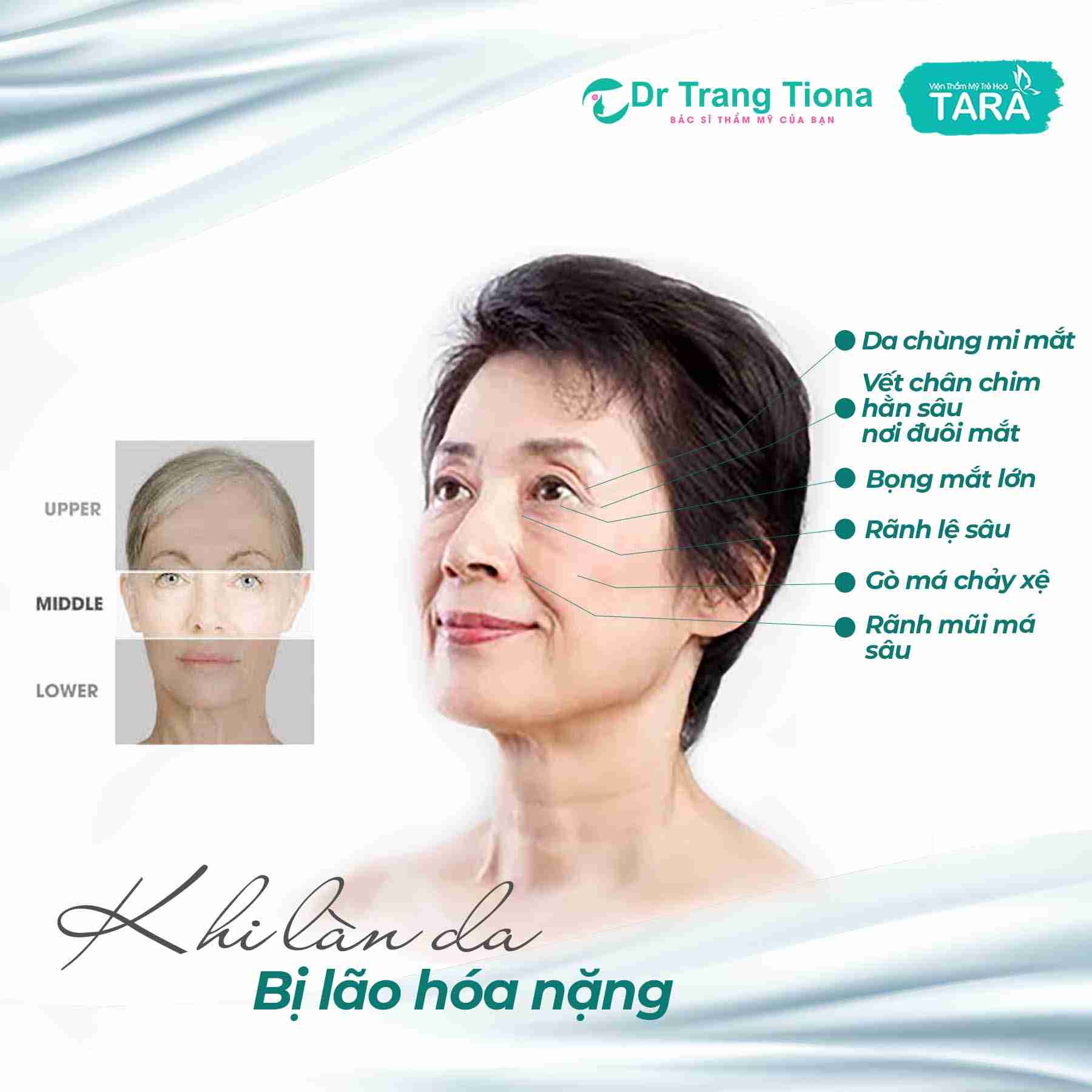 Căng da MIDFACE có tốt không? Có an toàn không?