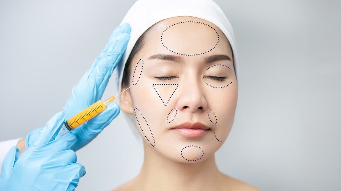 Cấy Mỡ Tạo Hình Khuôn Mặt 4T2N – Giải Pháp Lấy Lại Thanh Xuân Rực Rỡ