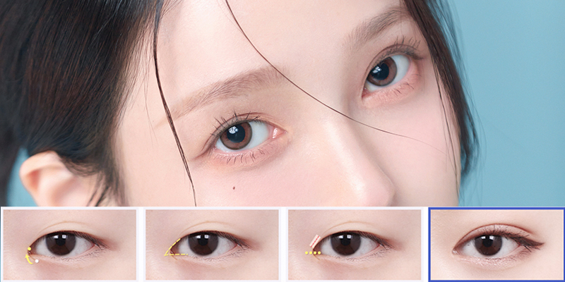 Mở rộng góc mắt