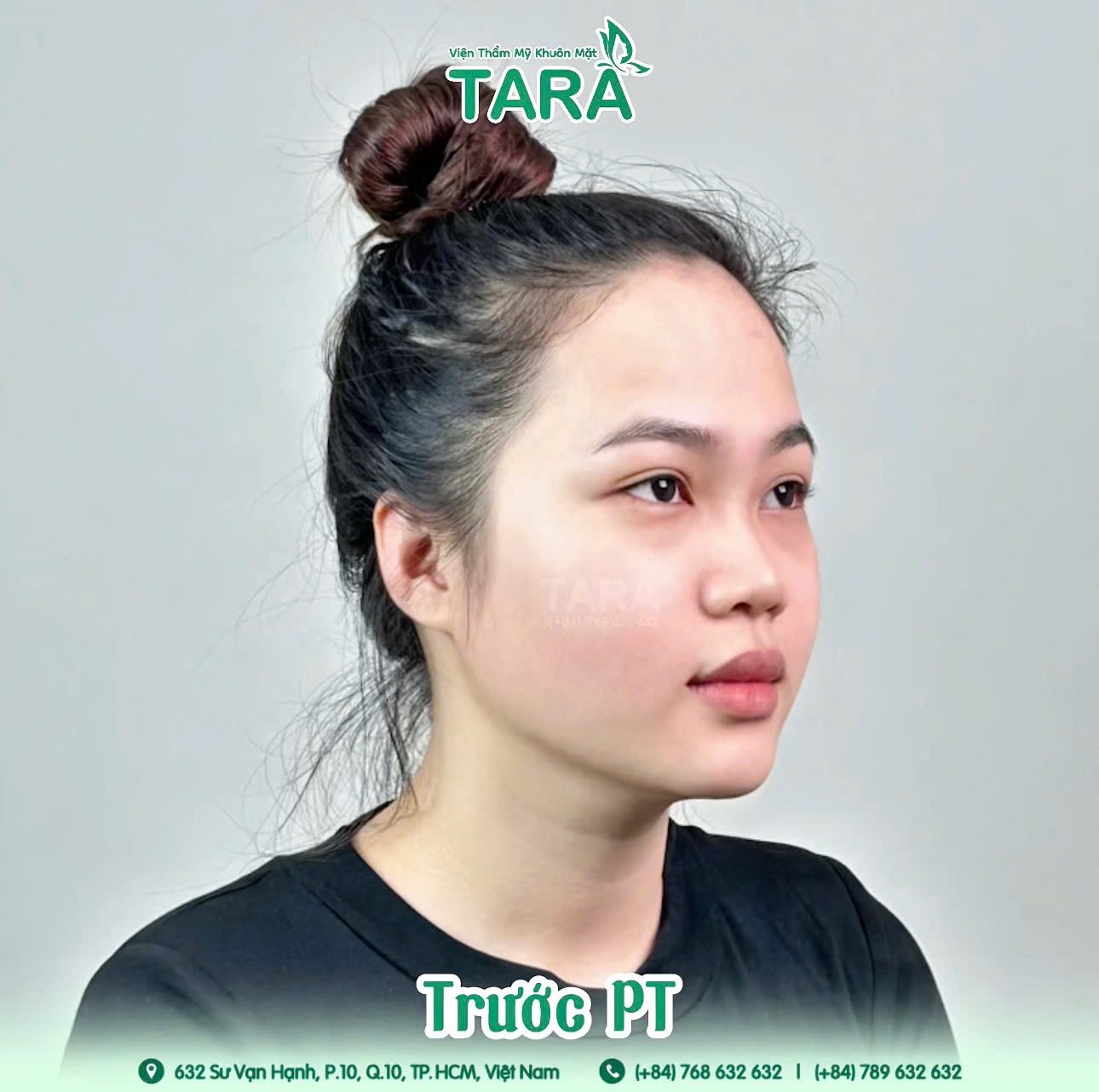 Trước
