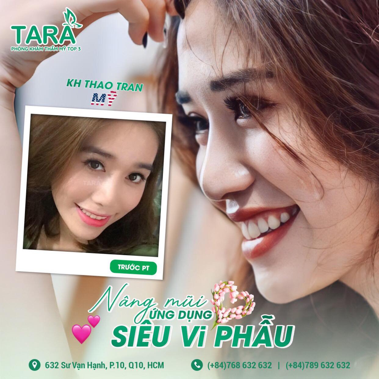 Phân biệt nâng mũi ứng dụng đeo kính lúp siêu vi phẫu và nâng mũi thường