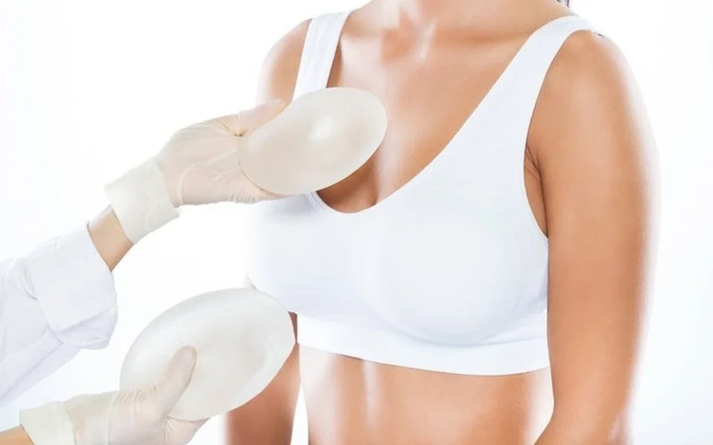 Nâng ngực Omega Preservé là gì? Hành trình lấy lại sự tự tin cho mẹ bỉm