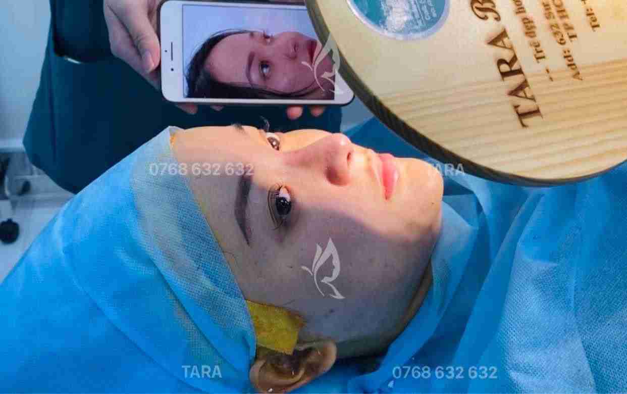 Sửa mũi có đau không?  và “GÂY TÊ ĐA TẦNG” by Dr Trang TARA