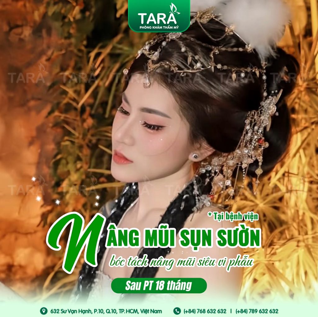 10+ câu hỏi “vàng” cần hỏi bác sĩ trước khi nâng mũi siêu vi phẫu
