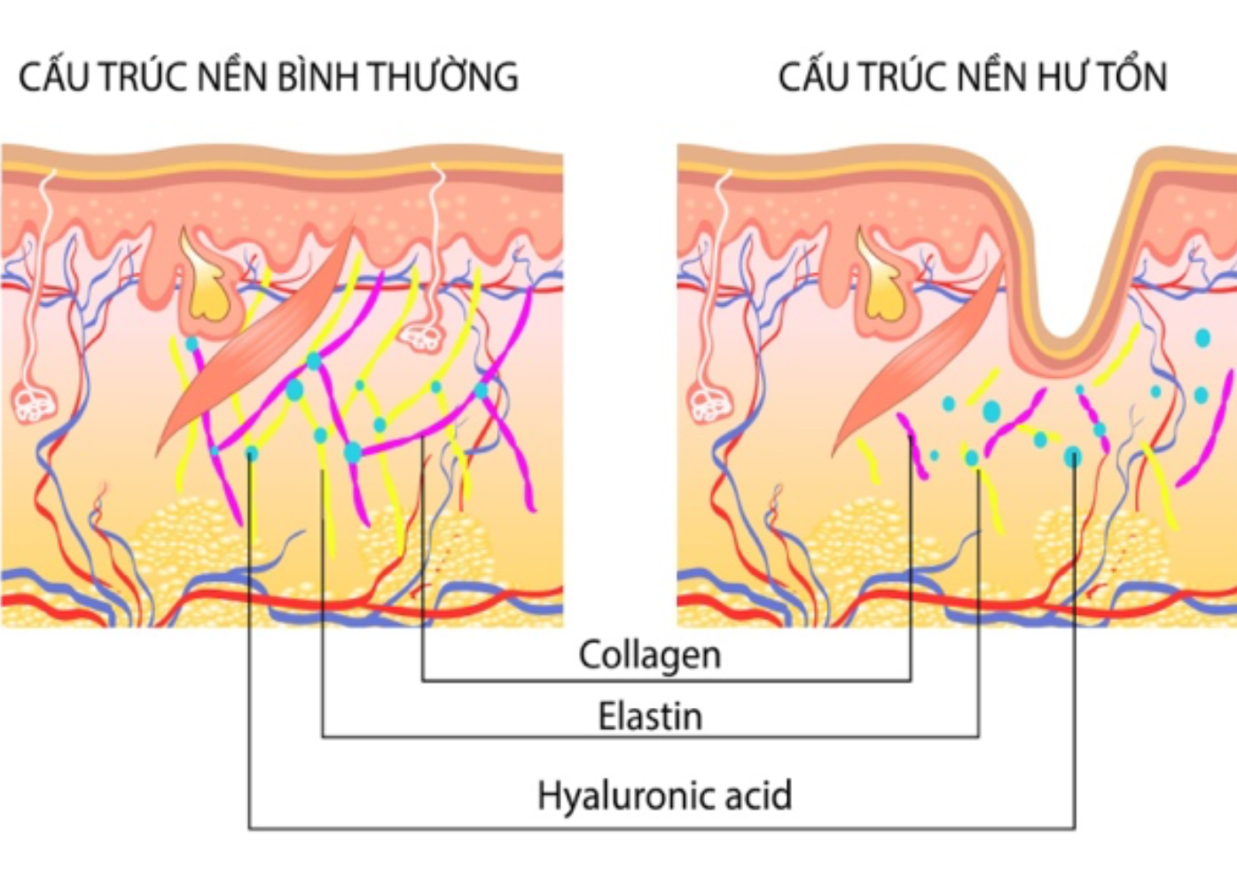5 thói quen tai hại khiến gương mặt trông già hơn