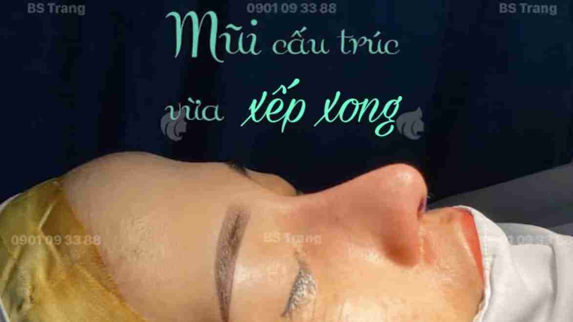 Bác sĩ Trang giải đáp: Mũi bị xơ cứng và cách điều trị