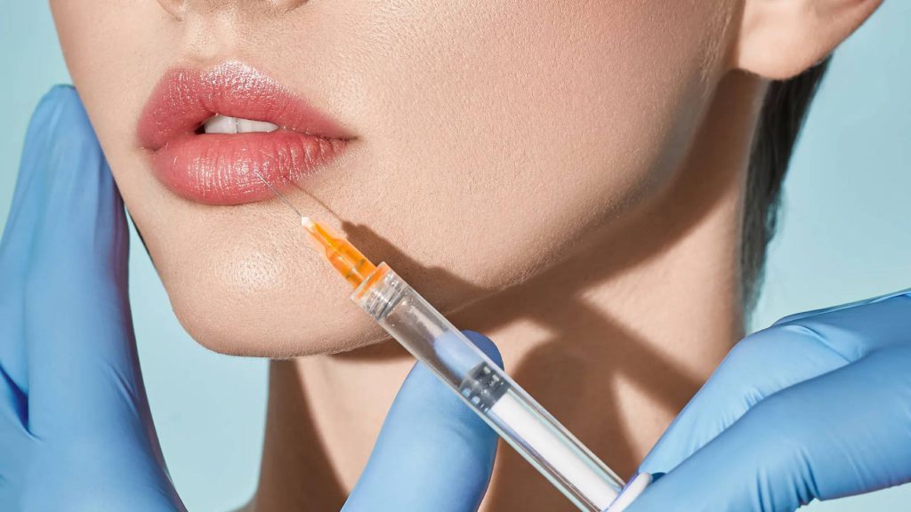 Bảng giá tiêm filler tạo hình khuôn mặt 2025