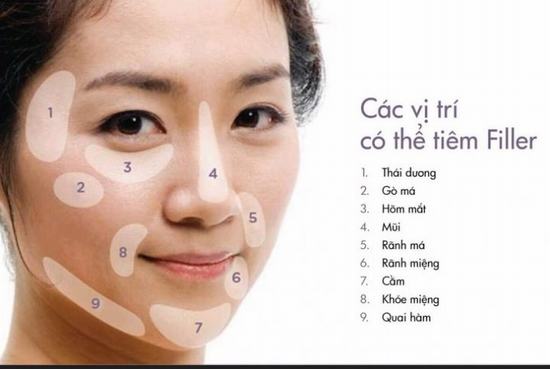 Tổng hợp các câu hỏi về tiêm trẻ hoá tạo hình khuôn mặt