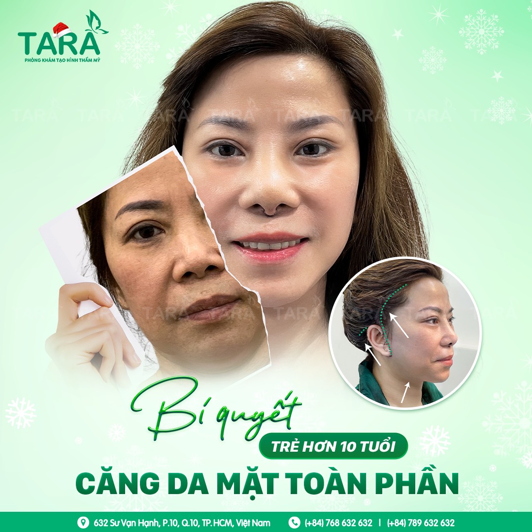 Căng da mặt toàn phần ảnh hưởng đến sức khoẻ không?