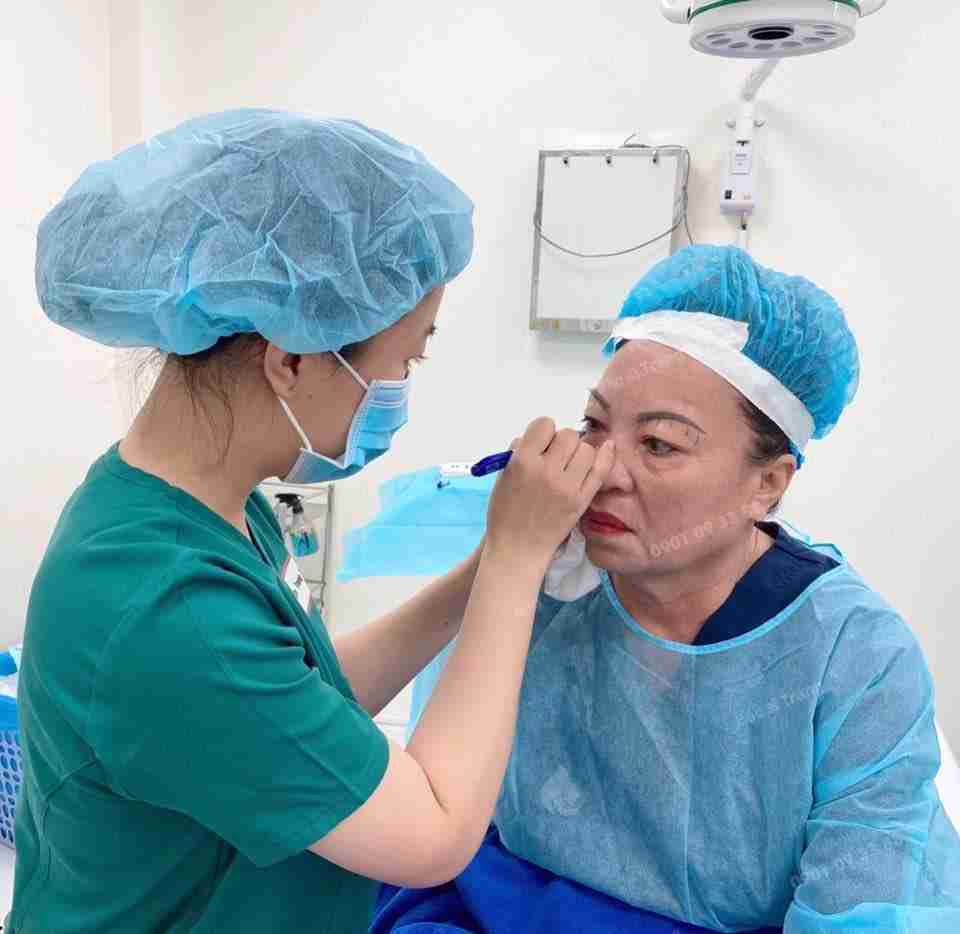 Căng da MIDFACE có tốt không? Có an toàn không?