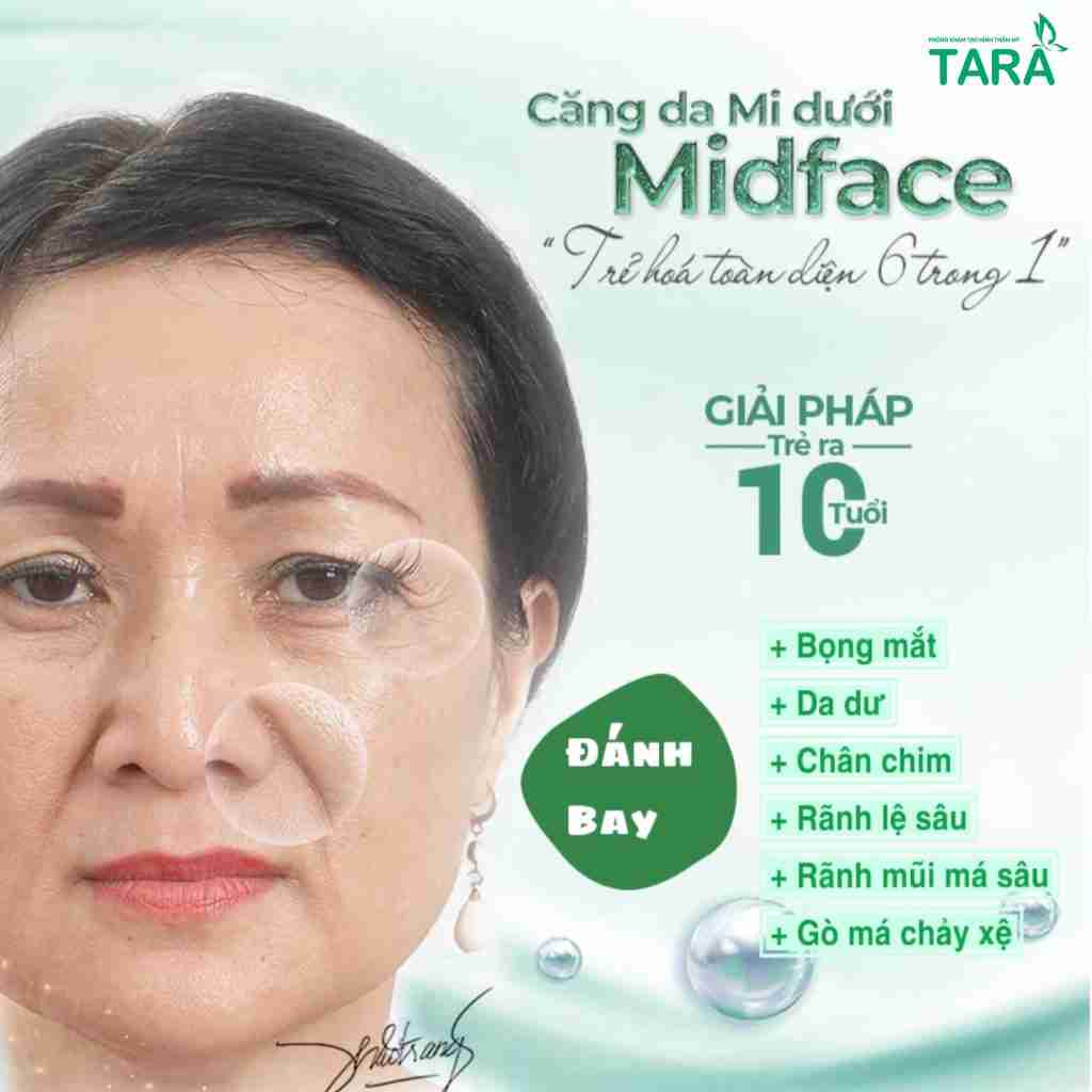 Căng da Midface ở đâu thì tốt và đặc điểm nhận biết