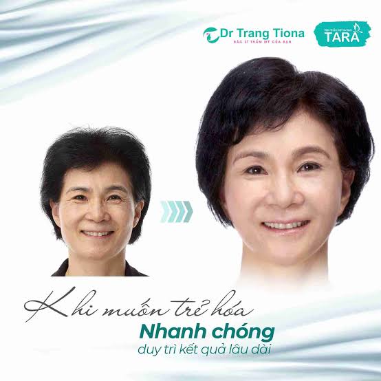 Căng Da Nâng Cơ Toàn Diện 3SD – Giải Pháp Trẻ Hóa Tầng Sâu Lưu Giữ Nét Thanh Xuân Dài Lâu