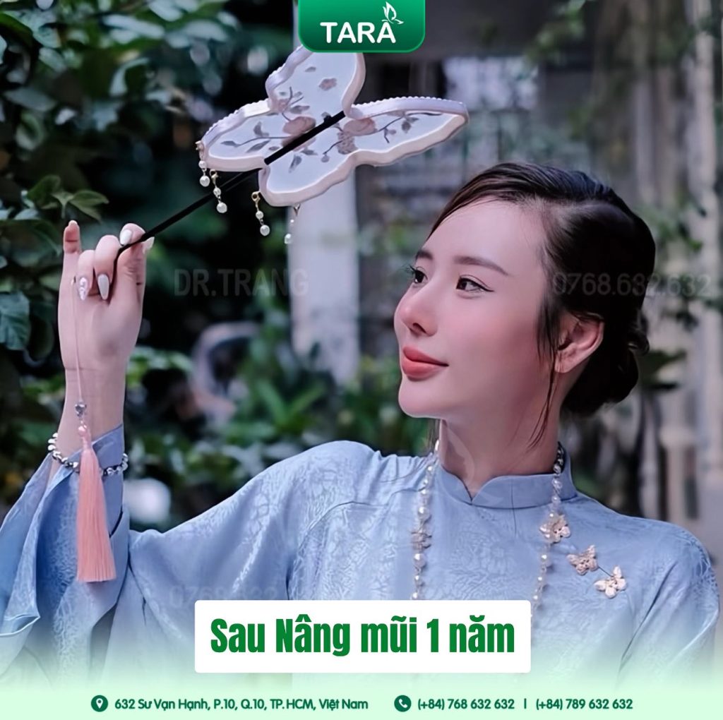 Chi phí nâng mũi siêu vi phẫu tại Bác sĩ Trang – Tara Clinic