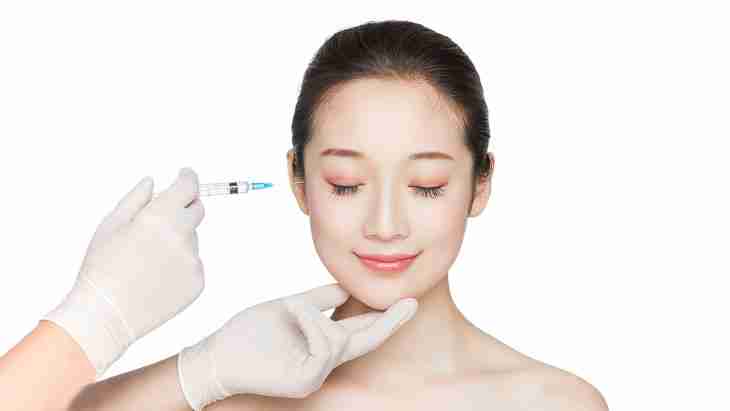 Có nên xóa rãnh lệ bằng phẫu thuật thẩm mỹ không?