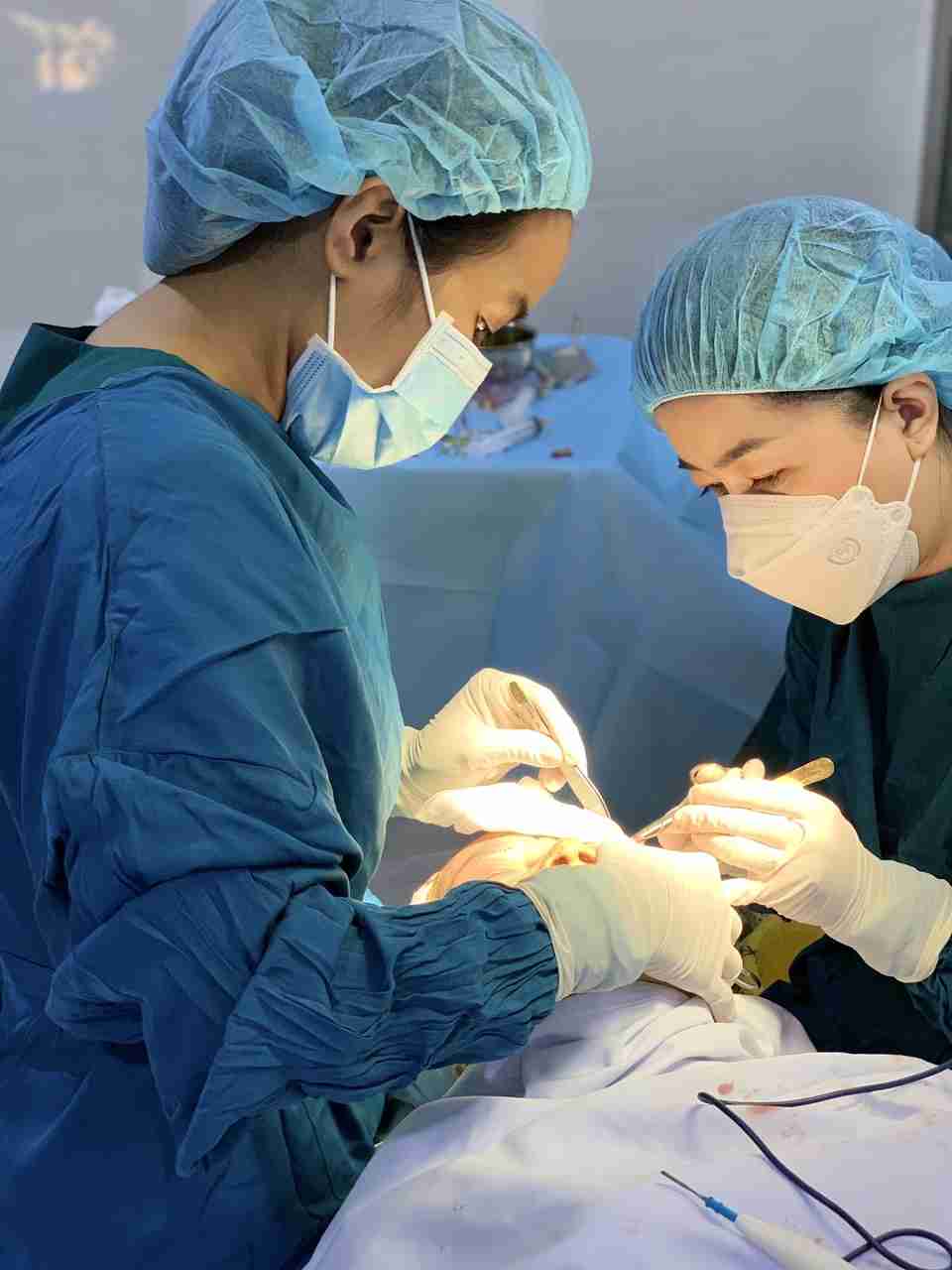 Có nên xóa rãnh lệ bằng phẫu thuật thẩm mỹ không?