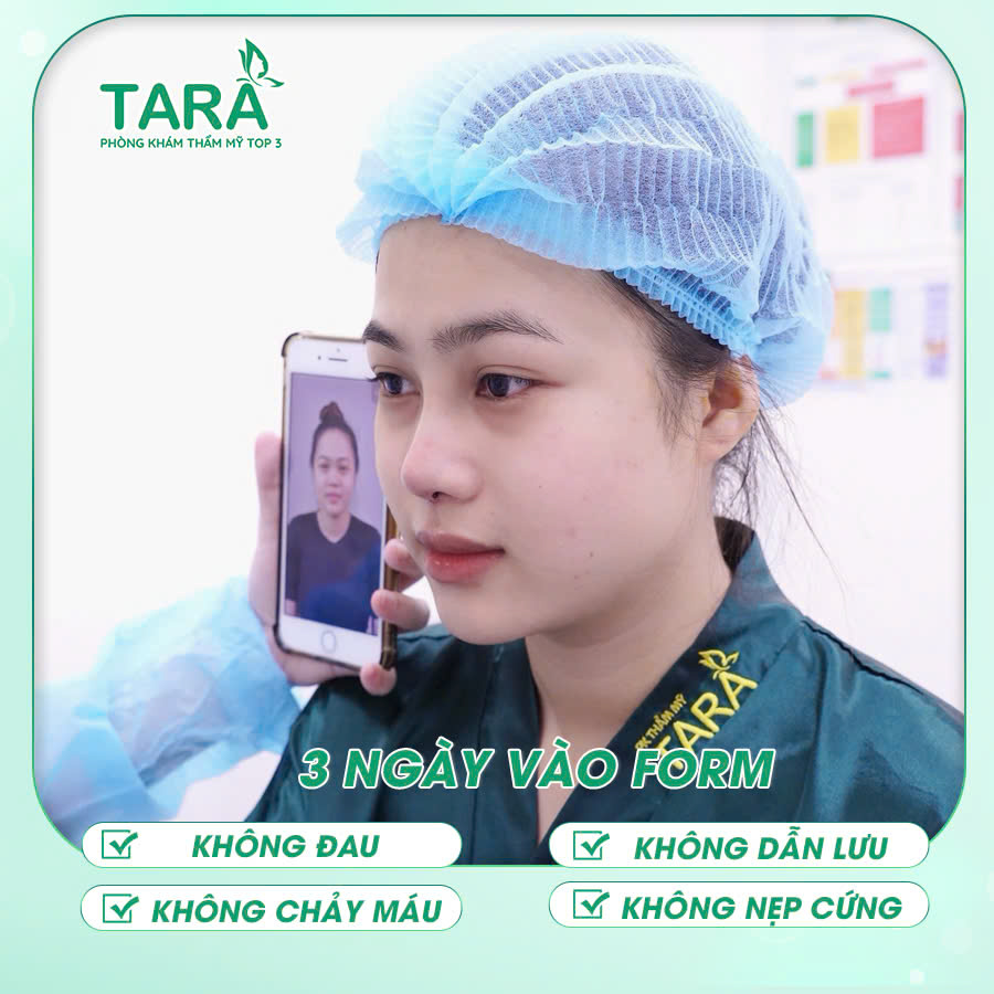Địa chỉ nâng mũi ứng dụng đeo kính lúp siêu vi phẫu không đau uy tín tại TPHCM