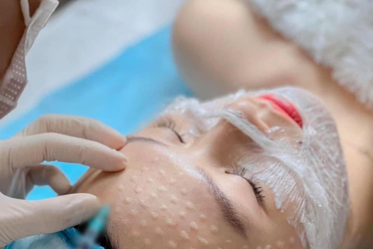 Giải đáp tổng hợp về tiêm căng bóng trẻ hoá da