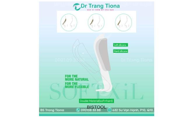 Tại sao nâng mũi đặt sống được nhiều chị em lựa chọn?
