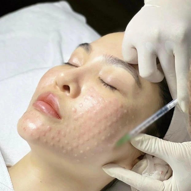 Giải pháp làn da căng bóng khi bước vào giai đoạn lão hoá?