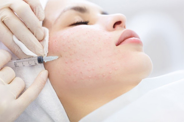 Hiểu rõ về 3 phương pháp tiêm trẻ hoá chính hiện nay