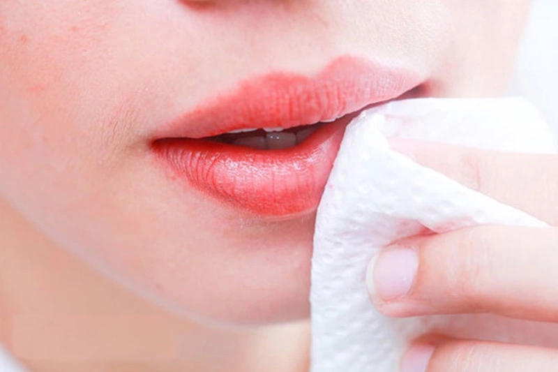 Hướng dẫn vệ sinh sau khi tạo hình môi cười