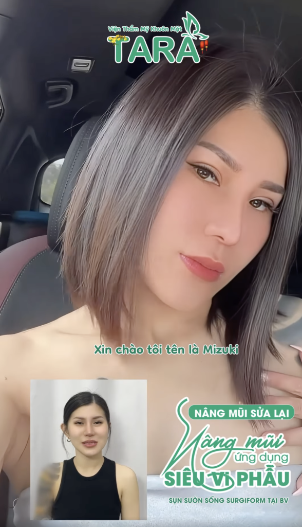 Chia sẻ từ khách hàng Malaysia nâng mũi ứng dụng đeo kính lúp siêu vi phẫu