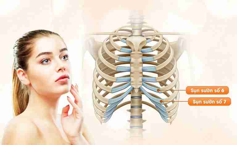 Lấy sụn sườn của người khác để nâng mũi được không?