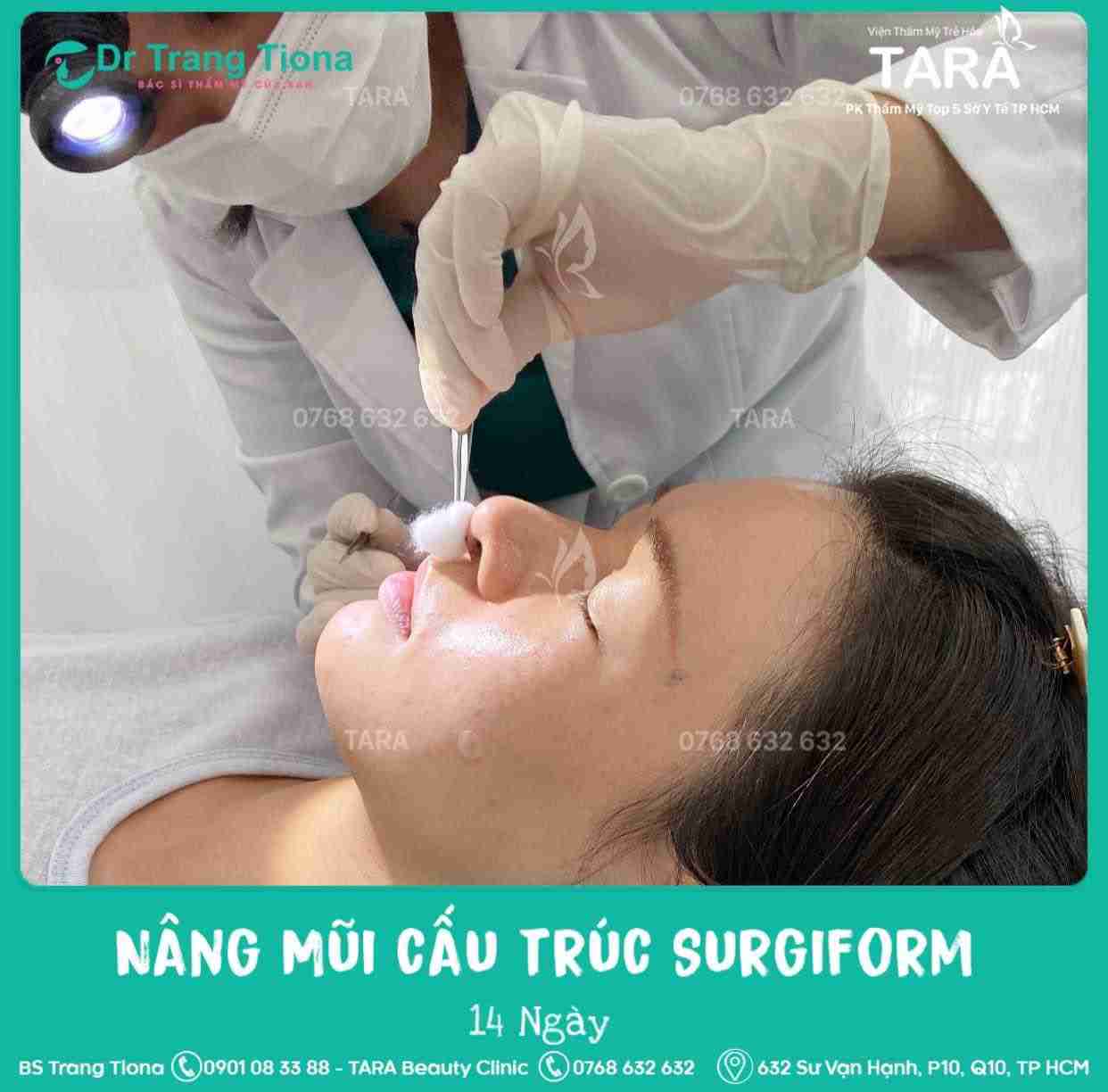 Mũi ngắn nên nâng mũi bằng phương pháp nào? Giá bao nhiêu?