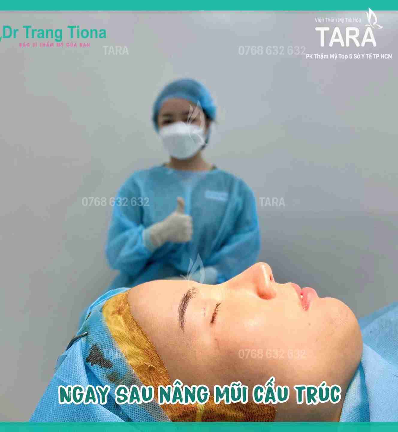 Mũi ngắn nên nâng mũi bằng phương pháp nào? Giá bao nhiêu?