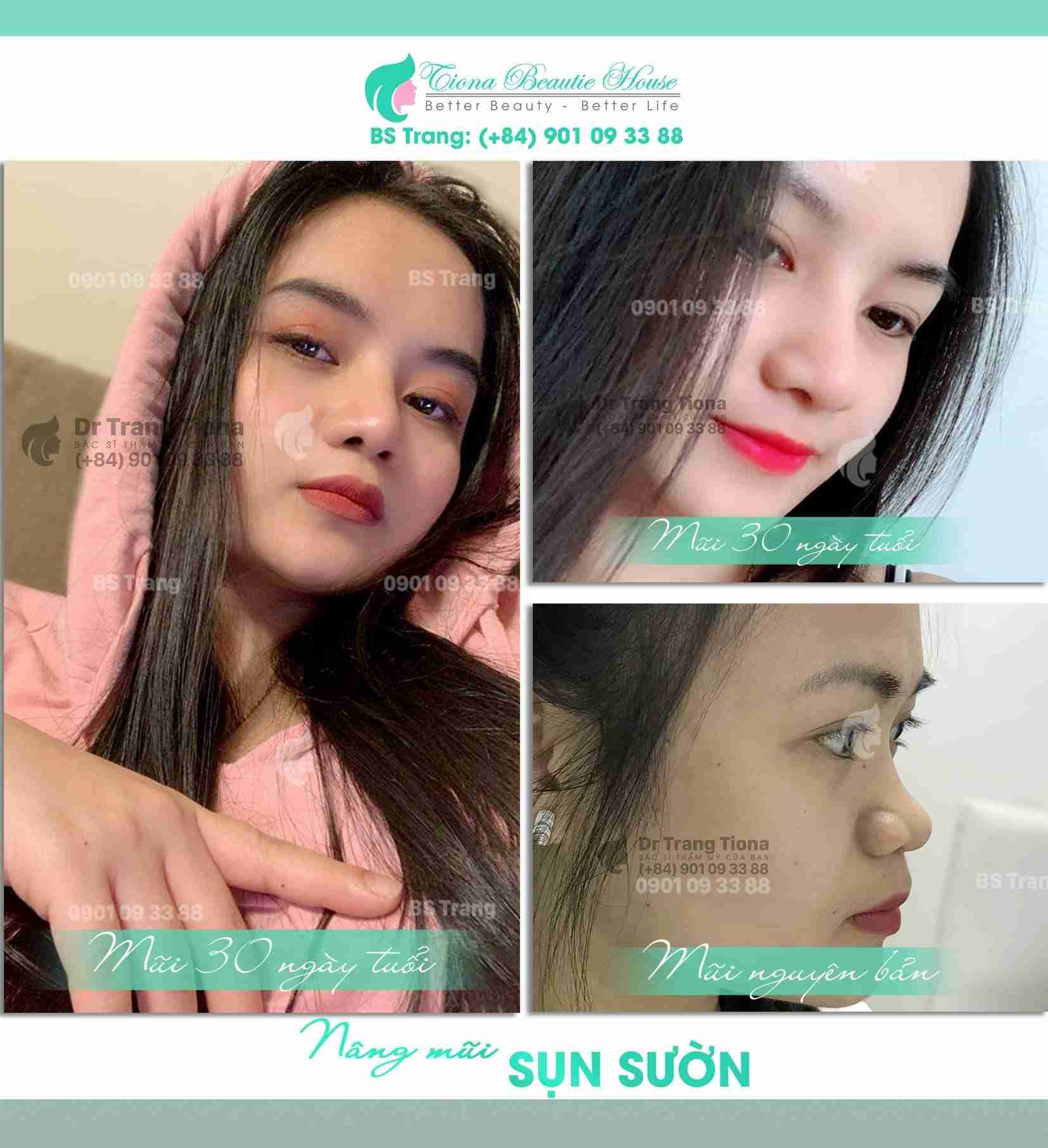 Mũi rồng là gì? Theo tướng số mũi rồng tốt hay xấu?