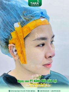 Mũi rồng, mũi lân, mũi két theo nhân tướng học: nên sửa hay giữ? (Giải pháp nâng mũi siêu vi phẫu tạo dáng mũi chuẩn tướng)