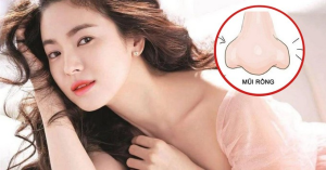 Mũi rồng, mũi lân, mũi két theo nhân tướng học: nên sửa hay giữ? (Giải pháp nâng mũi siêu vi phẫu tạo dáng mũi chuẩn tướng)