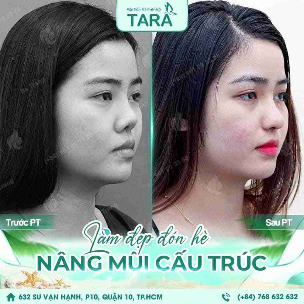 Nâng mũi bị tê đầu mũi có nguy hiểm không?