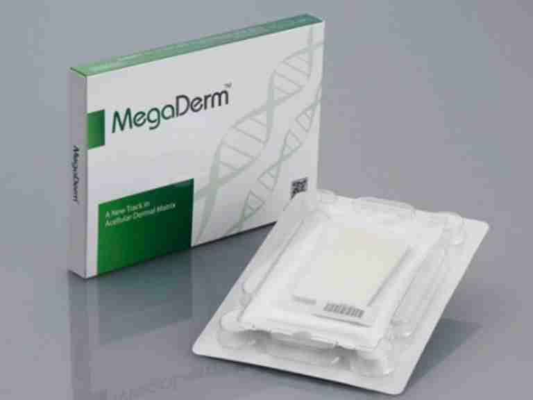 Tổng quan về phương pháp nâng mũi bọc sụn Megaderm