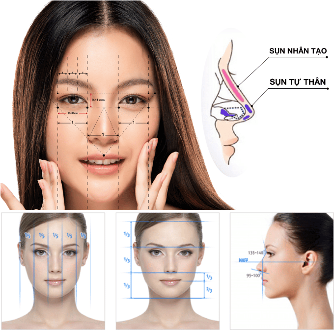 Nâng mũi cấu trúc có thật sự an toàn?