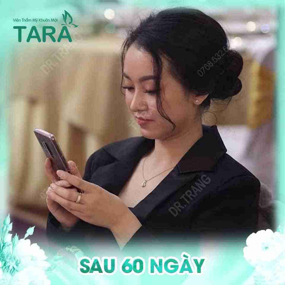 Nâng mũi có để lại di chứng phẫu thuật không? Cách phòng tránh?