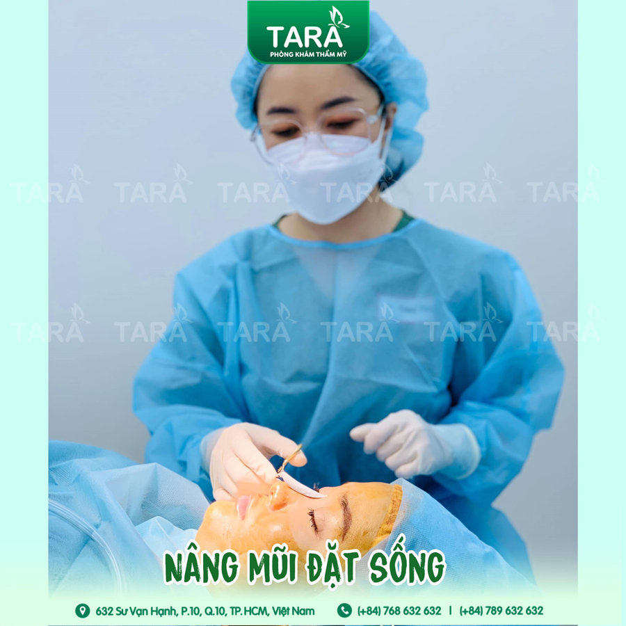 Nâng mũi ERAS 5i: Nâng mũi tháo nẹp sớm
