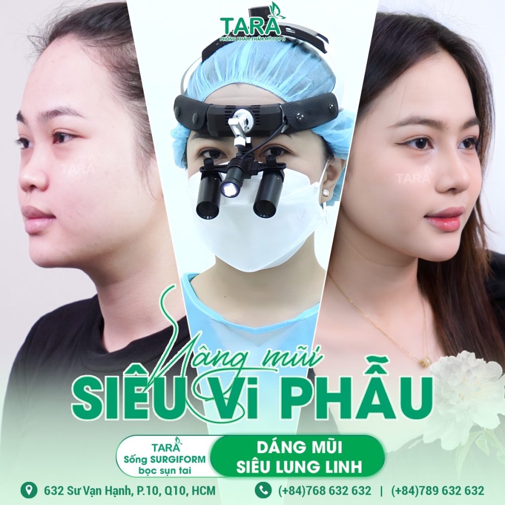 Nâng mũi siêu vi phẫu bằng sụn nhân tạo: Lựa chọn phù hợp cho từng dáng mũi