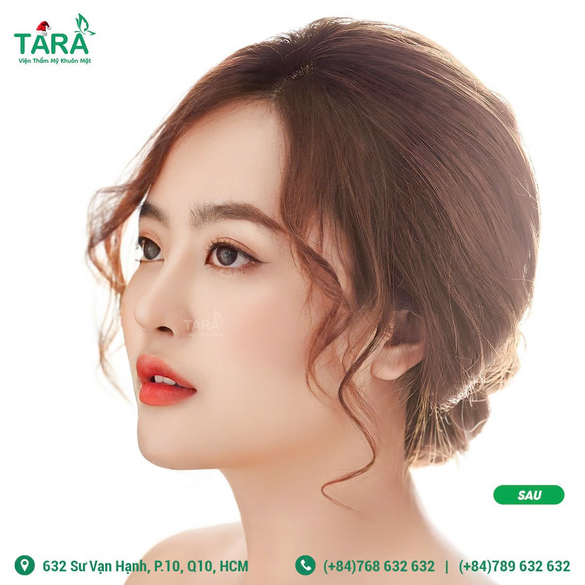 Nâng mũi ứng dụng đeo kính lúp siêu vi phẫu có để lại sẹo không?