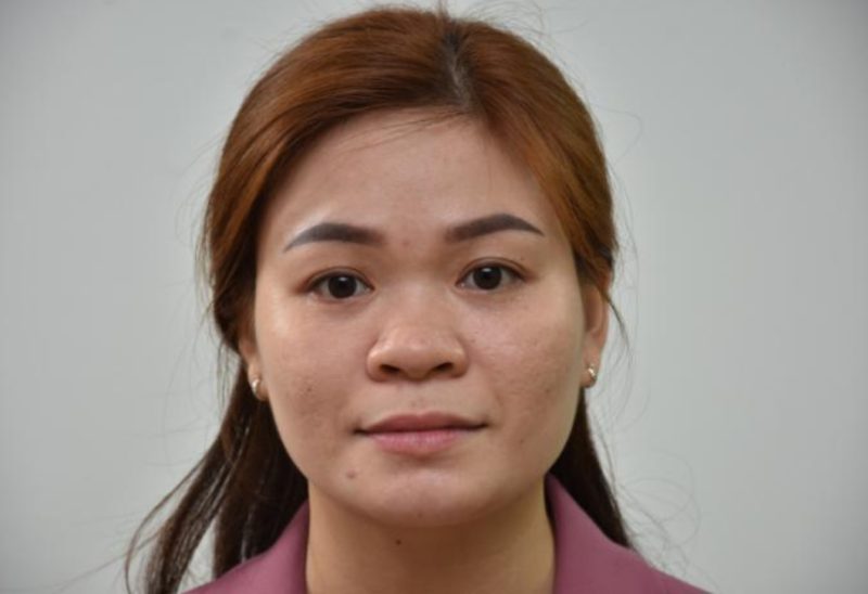 Hiểu về nâng mũi ứng dụng đeo kính lúp siêu vi phẫu cho người mũi tẹt