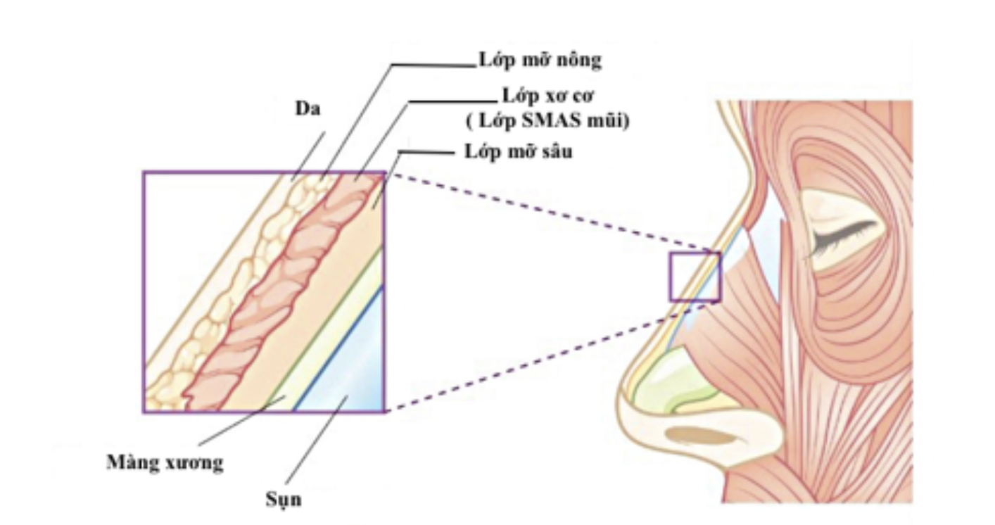 Lựa chọn Nâng mũi siêu vi phẫu và Các phương pháp Nâng mũi khác?