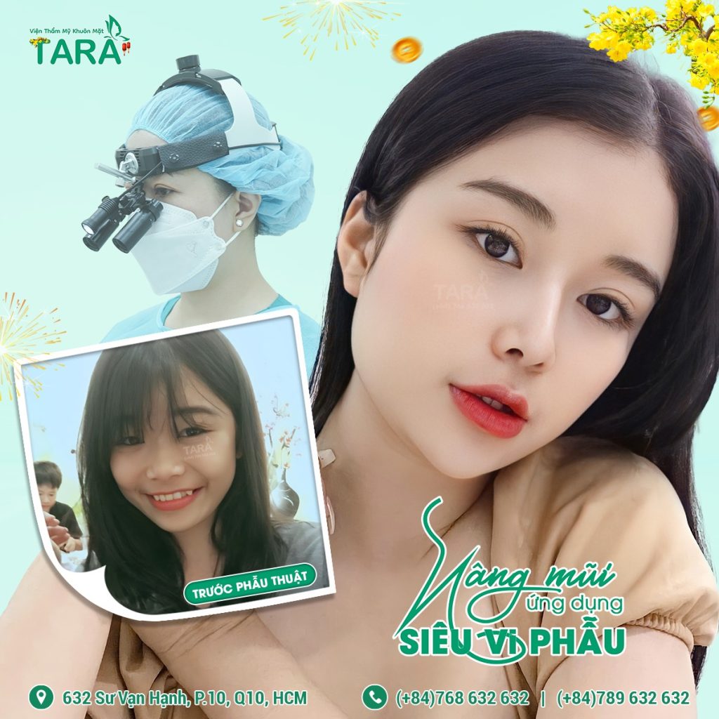 Phân biệt nâng mũi ứng dụng đeo kính lúp siêu vi phẫu và nâng mũi thường