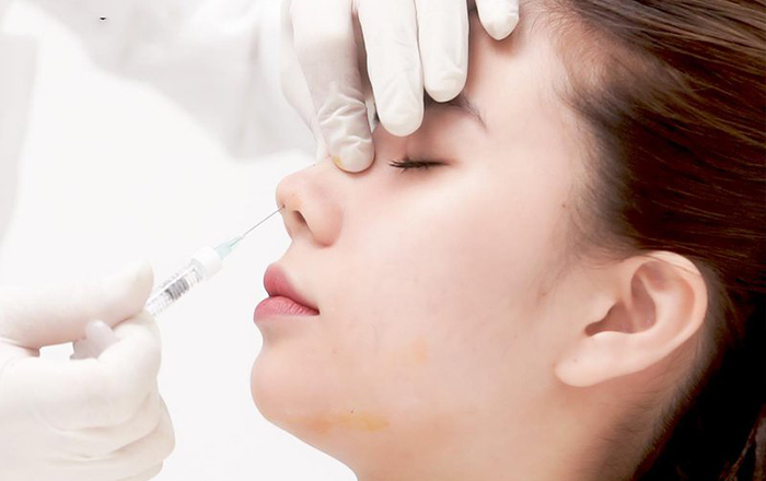 So sánh nâng mũi siêu vi phẫu so với tiêm filler, nâng mũi chỉ