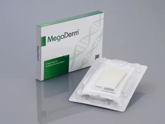 Nâng mũi sống Surgiform là gì? Nâng mũi sống Surgiform có tốt không?