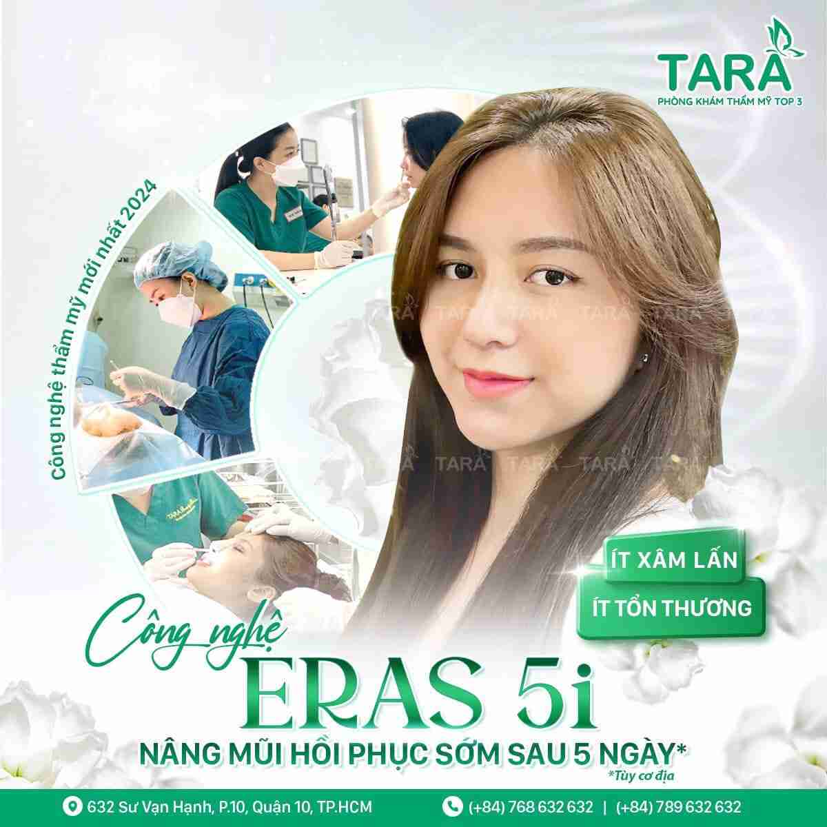 Nâng mũi sống Surgiform là gì? Nâng mũi sống Surgiform có tốt không?