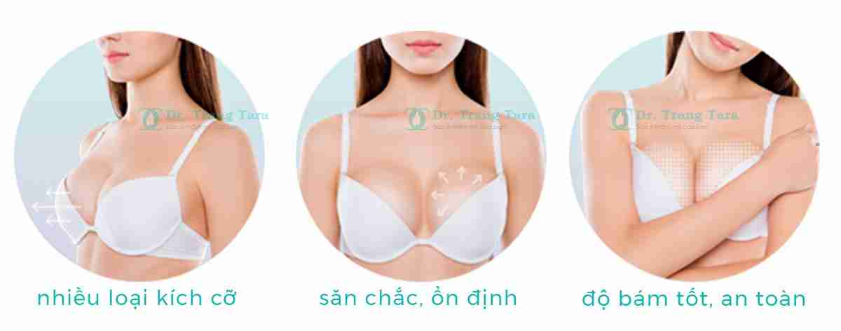 Nâng ngực bằng túi Mentor – Giải pháp quyến rũ cho “cặp tuyết lê” của nàng