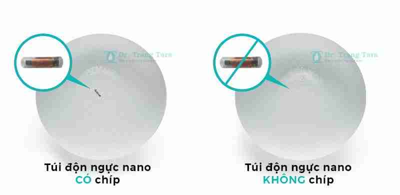 Nâng ngực bằng túi Nano Chip hiện đại | Bí quyết sở hữu vòng 1 quyến rũ