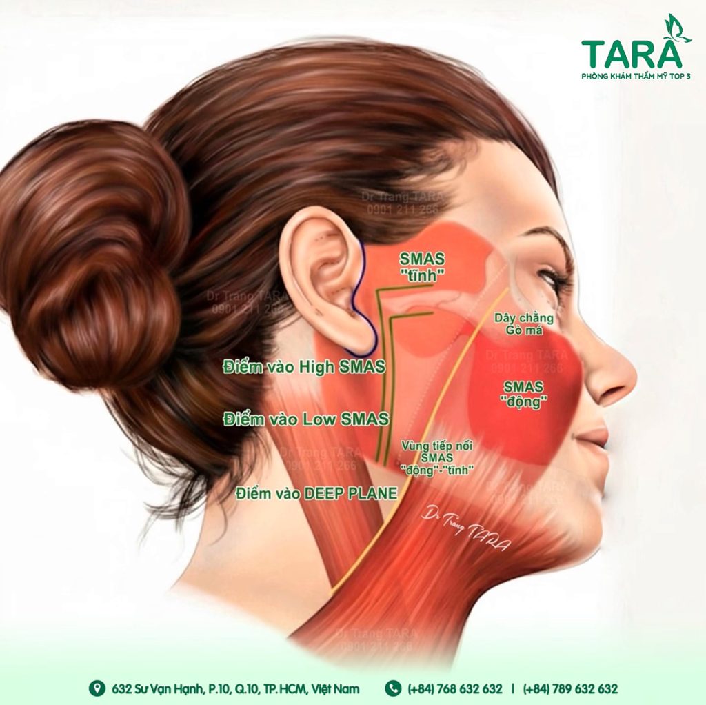 Phẫu thuật căng da mặt tại ở đâu tốt, uy tín?