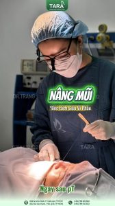 Tại sao cần phẫu thuật nâng mũi siêu vi phẫu chuẩn y khoa