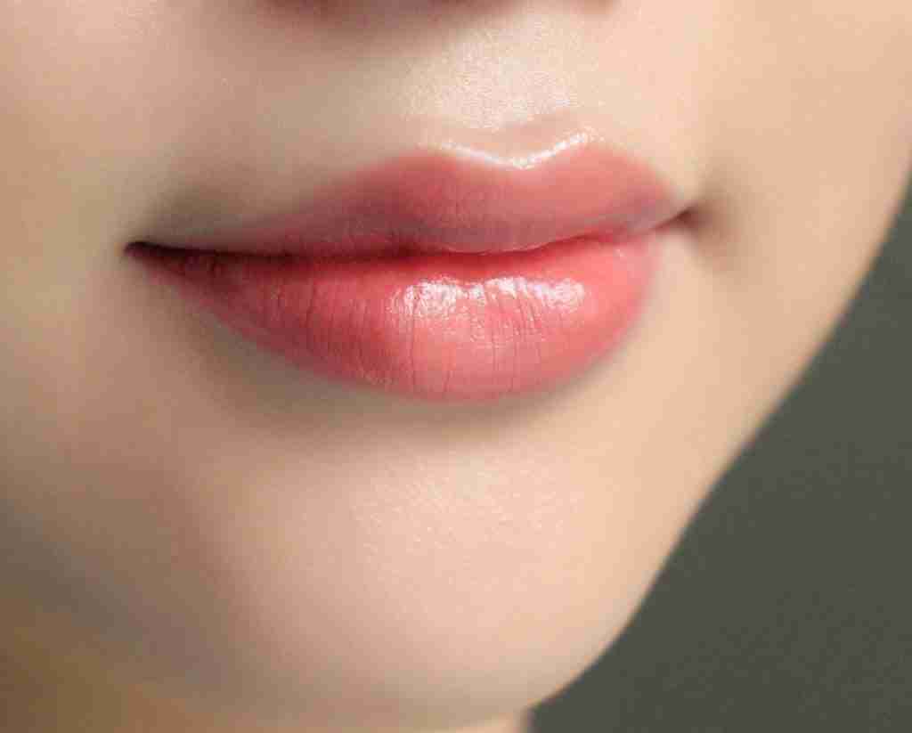 Từ A-Z về phương pháp phẫu thuật môi cười